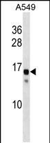 1 - SSX11 Antibody (N-term) AP19075a