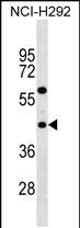 1 - TAS2R3 Antibody (C-term) AP19081b