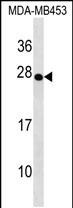 1 - TRDC Antibody (Center) AP19091c