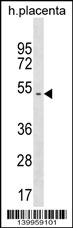 1 - YR011 Antibody (Center) AP19099c