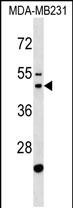 1 - GATSL1 Antibody (N-term) AP19129a