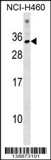 1 - KRBOX1 Antibody (C-term) AP19145b