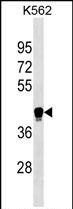 1 - LILRA6 Antibody (Center) AP19146C