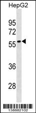1 - LRRC69 Antibody (Center) AP19147c