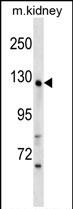 1 - WDR64 Antibody (N-term) AP19154A