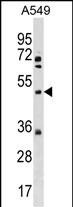 1 - XK Antibody (N-term) AP19173A
