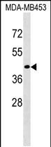 1 - CD200R1L Antibody (N-term) AP19174a