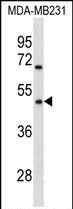 1 - OR1Q1 Antibody (C-term) AP19192b