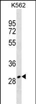 1 - ZNF365 Antibody (Center) AP19210c