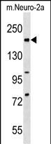1 - Mouse Rad50 Antibody (C-term) AP19224b