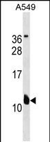 1 - KCNE2 Antibody (C-term) AP19267b