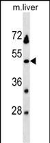 1 - KLKBL4 Antibody (C-term) AP19280b