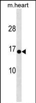1 - HIGD1C Antibody (C-term) AP19281b