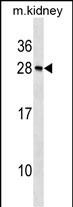 1 - Mouse Rcvrn Antibody (N-term) AP19308a