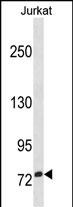 1 - ZNF274 Antibody(N-term) AP19398a