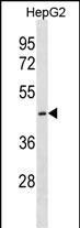 1 - CTNS Antibody(C-term) AP19410b