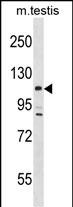 1 - Mouse Lats2 Antibody(C-term) AP19422b