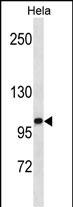 1 - ZHX1 Antibody(C-term) AP19424b