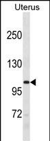 1 - RECQL5 Antibody(Center) AP19444c