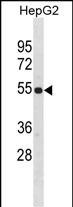 1 - ZNF101 Antibody(Center) AP19482c