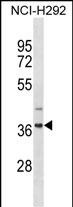 1 - ZNF696 Antibody(N-term) AP19572a