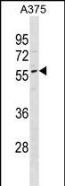 1 - DPCR1 Antibody(Center) AP19577c