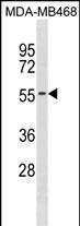 1 - KCNK6 Antibody(C-term) AP19580b