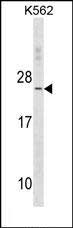 1 - TNNC2 Antibody(C-term) AP19581b