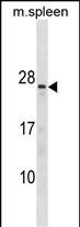 1 - TNNC2 Antibody(C-term) AP19581b