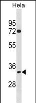 1 - TIPIN Antibody(N-term) AP19596a