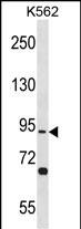 1 - TSGA10 Antibody(N-term) AP19598a