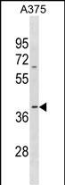 1 - OR13D1 Antibody(C-term) AP19604b