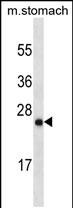 1 - LYPD6B Antibody (Center) (Ascites) AM2160a