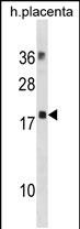 1 - MYL12B Antibody(N-term) AP19667a