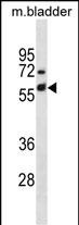 1 - Mouse Krt6a Antibody(Center) AP19689c