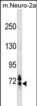 1 - Mouse Senp1 Antibody(Center) AP19695c