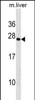 1 - PRRX2 Antibody (C-term) AP19763b