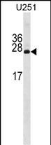1 - PDAP1 Antibody (N-term) AP19777a