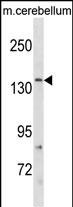 1 - GRIN2C Antibody (Center) AP19779c