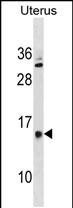 1 - GALNTL5 Antibody(N-term) AP19796a