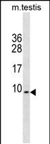 1 - PDE6H Antibody(Center) AP19799c