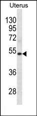 1 - KRT72 Antibody(Center) AP19811c