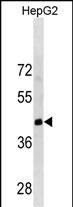 1 - LRRC19 Antibody(C-term) AP19872b