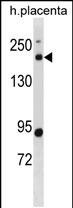 1 - BCL9L Antibody(N-term) AP19875a