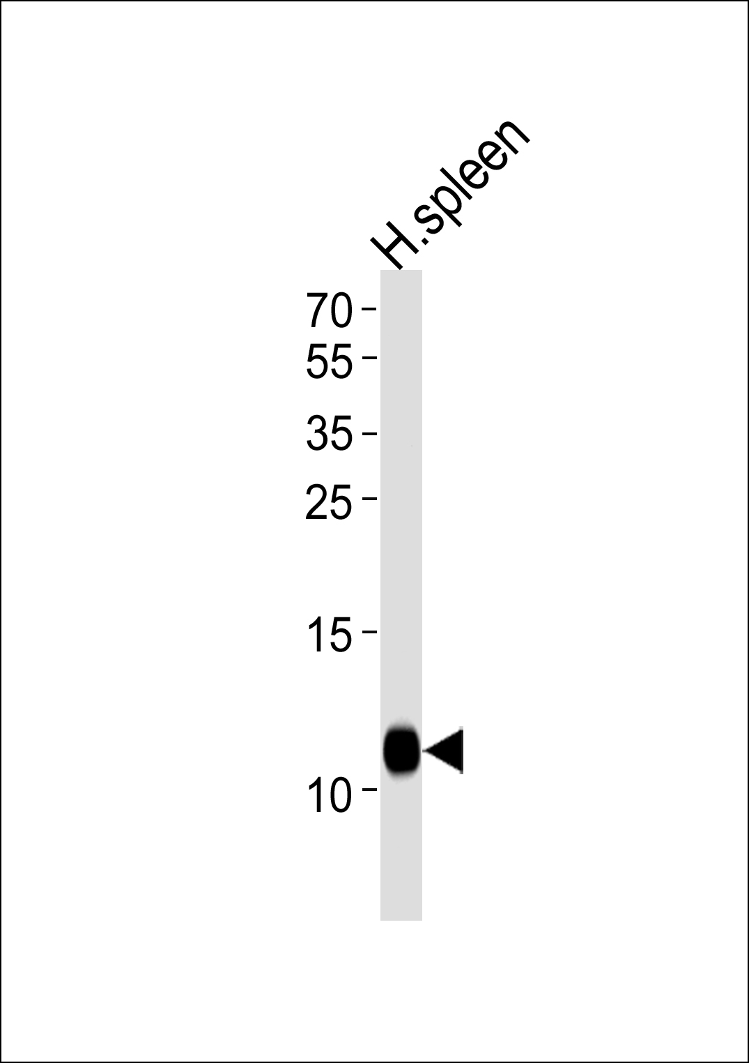 1 - FCER1G Antibody (C-term) AP19903b