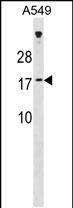 1 - SSX7 Antibody (N-term) AP19917a