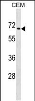 1 - ZNF93 Antibody (N-term) AP20006A