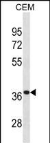 1 - TTPA Antibody (Center) AP20030c