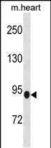 1 - PDE8B Antibody (Center) AP20045c