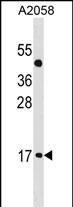 1 - ATOH7 Antibody (Center) AP20067c